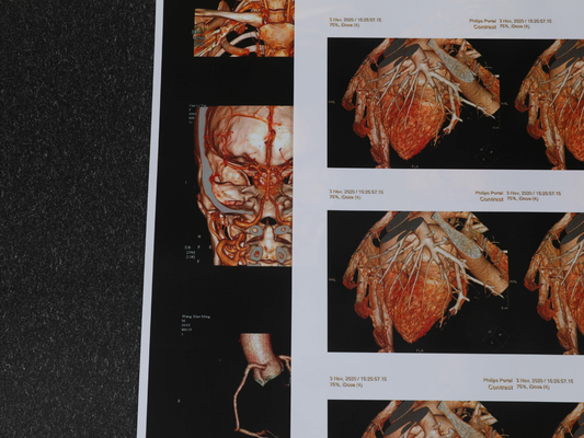 240gsm 180 filme médico da caixa do filme 3D CT do Inkjet do mícron a favor do meio ambiente