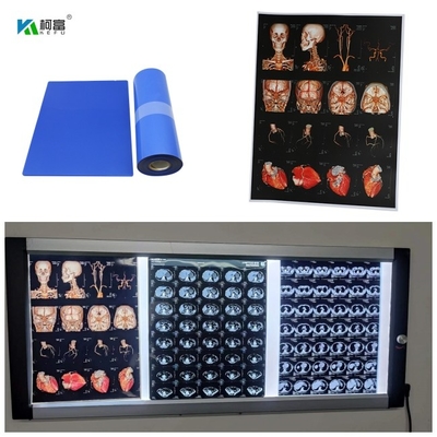Inkjet médico baixo azul X Ray Film For Digital Image 280gsm para a imagem da cor 14x17inch