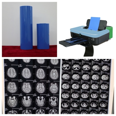 210 Microns Blue Base Inkjet Printing X Ray Film Com Resolução 9600x2400dpi Para A3+ CR DR