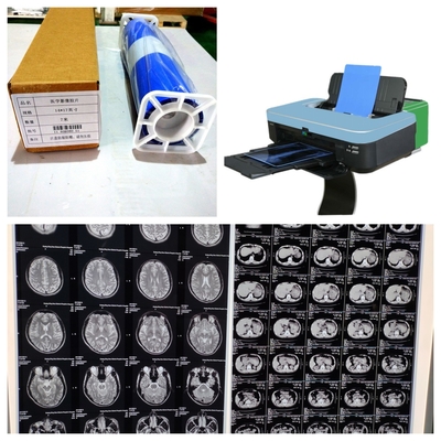 Filmes médicos de raios-X com custo razoável e alta estabilidade de imagem