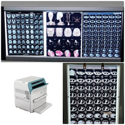 Filme de raios-X Médicos de Baixo nevoeiro com Resolução de 320dpi 14 x 17 em Led X Ray Film View Box