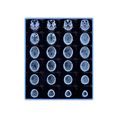 Película de jato de tinta azul para impressão gráfica médica por raios-X