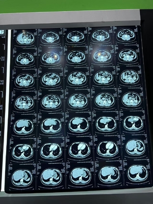 Filme de impressão térmica de radiografia a laser azul para equipamento médico de raios-X