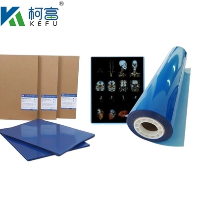 Dimensão personalizada 35x43 Inkjet Filme de raios X Médico Azul Para Epson A4 PET Laser Médico Azul Seco