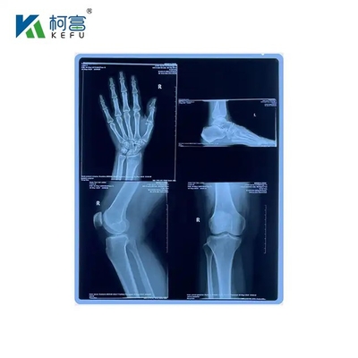 Película de laser médica de longa duração e baixa manutenção 16x21in 0.17mm Manter a qualidade da imagem durante longos períodos com manutenção mínima
