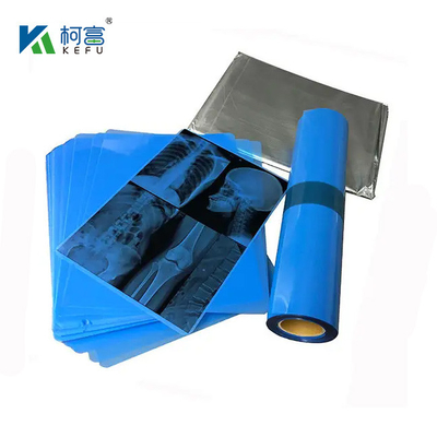 175mic 215mic High Definition Medical Imaging CT DR Inkjet Blue Film Medical X-ray Pet Film A3 A4 Transparente Filme de Impressão Azul