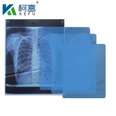 Filme de laser médico resistente à água e a produtos químicos, 10x14 polegadas, 0,13 mm, adequado para uso em ambientes médicos duros e úmidos