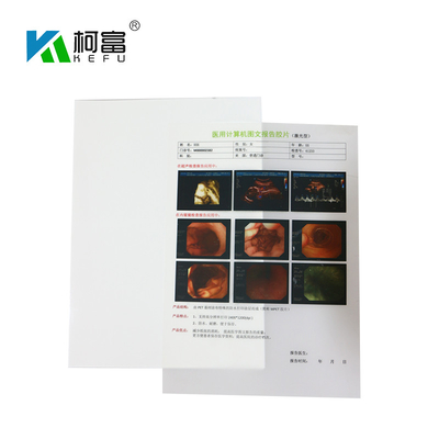 125 mícrons de filme de impressão branco do Inkjet do Inkjet X Ray Film A4 B5 16K