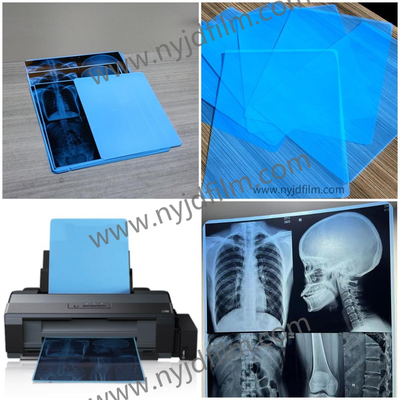 210 mícrons de filme azul de X Ray Film Medical Inkjet Printing para o hospital