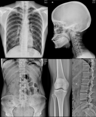 SR. impermeável médico DR. Digital do CR do CT do filme do Inkjet de A3 A4 X Ray Film