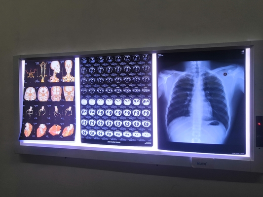 o laser impermeável X Ray Film de 210mmx297mm 150 mícrons de OKI fotocopia a impressora Film de Fuji