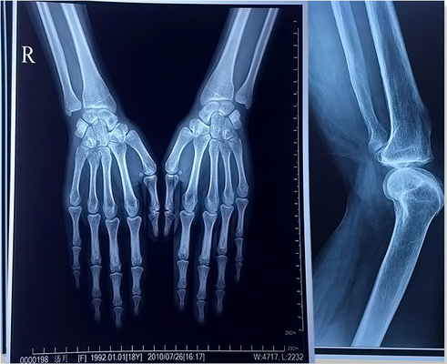 ISO 9001 24 filmes 30m médicos da polegada X X Ray Film Blue Laser Transparency para hospitais