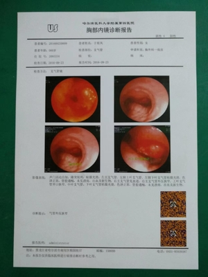 OEM branco baseado ANIMAL DE ESTIMAÇÃO do Inkjet X Ray Film do filme seco médico de 125um 150um 180um