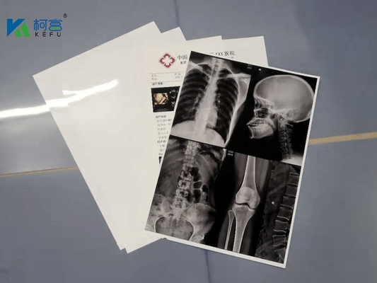 ” 180 mícrons brancos do ANIMAL DE ESTIMAÇÃO 13X17 X Ray Film Sheets Transparency Film para impressoras a jato de tinta
