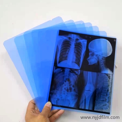 departamento azul impermeável do laser X Ray Film For Hospital Radiology da polegada 13x17