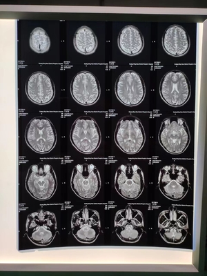 210 mícrons de Inkjet X Ray Film A3