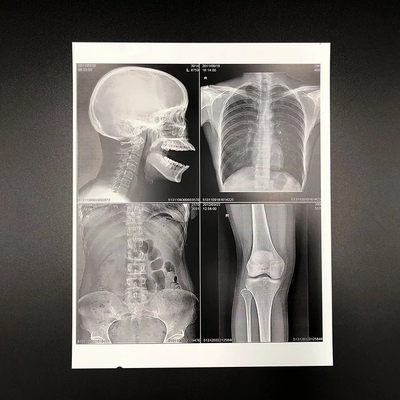 O ANIMAL DE ESTIMAÇÃO amigável de Eco baseou o Inkjet branco X Ray Film do filme seco médico 150 mícrons