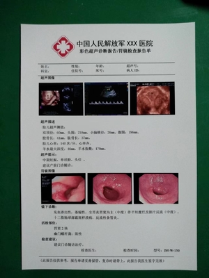 O ANIMAL DE ESTIMAÇÃO amigável de Eco baseou o Inkjet branco X Ray Film do filme seco médico 150 mícrons