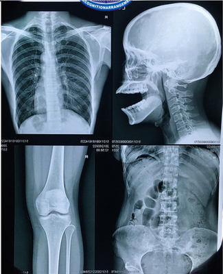 Filme médico azul baseado ANIMAL DE ESTIMAÇÃO do laser da polegada de X Ray Film 8x10 para a saída da imagem de Digitas