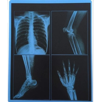 195 do ANIMAL DE ESTIMAÇÃO X Ray Film 10x12 da polegada mícrons de impressora azul do laser X Ray Film For Fuji OKI