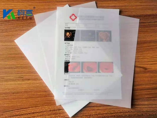 Impressão de filme de raios X a laser Excelente resistência UV e boa resistência à umidade