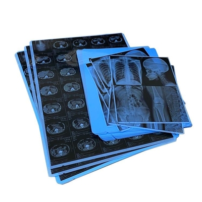 Resina A4 A3 Filme de Raios X Médicos para Gráficos de Radiologia
