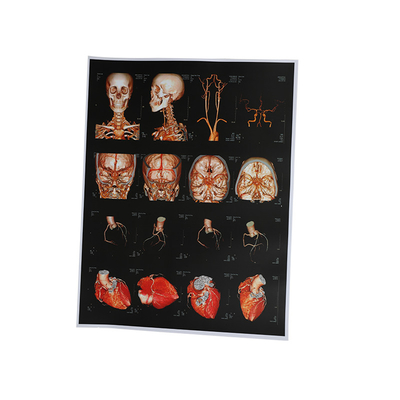 Inkjet X Ray Film do OEM 210um