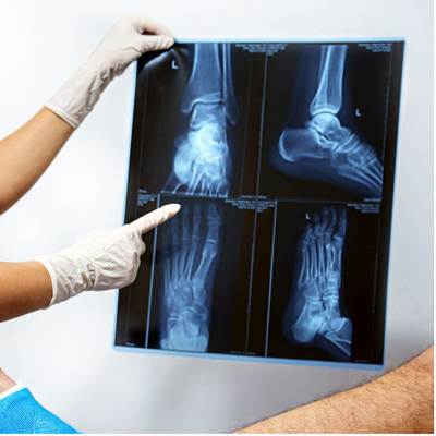 Resina A4 A3 Filme de Raios X Médicos para Gráficos de Radiologia