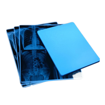 Resina A4 A3 Filme de Raios X Médicos para Gráficos de Radiologia