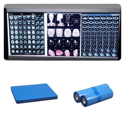 210microns base branca baixa azul da polegada médica do CR 8x10 do Dr. do Inkjet X Ray Films For