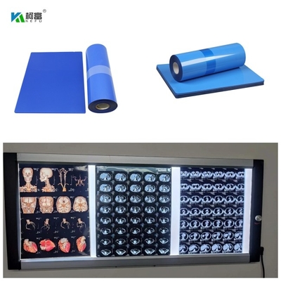 O rolo médico 8x10 14x17 A4 A3 100 do Inkjet azul X Ray Film 210 Micorn 10inch da base cobre