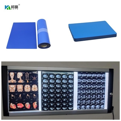 O filme 8x10 13x17 14x17 A4 A3 100 do Inkjet X Ray Medical Blue Base Dry de 210 mícrons cobre
