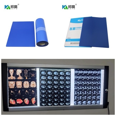 A tinta baixa azul médica 14inch X da tintura do Dr. CT MRI do Inkjet X Ray Film 125 folhas rola 10x12