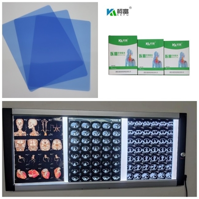 Inkjet médico X Ray Films do Dr. CT MRI 210 mícrons de rolo baixo azul da tinta 8x10 A4 A3 10inch