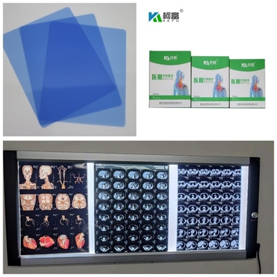 Saída 280gsm X médico Ray Film Inkjet Blue Base para a imagem 10x12 11x14 A4 A3 do Dr. CT MRI