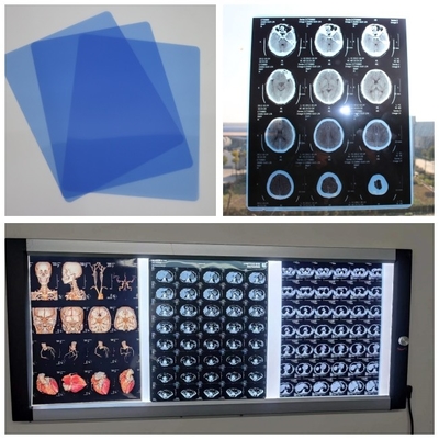 Filme seco do Inkjet médico baixo azul para Digitas X Ray Image With 210microns A3 13x17