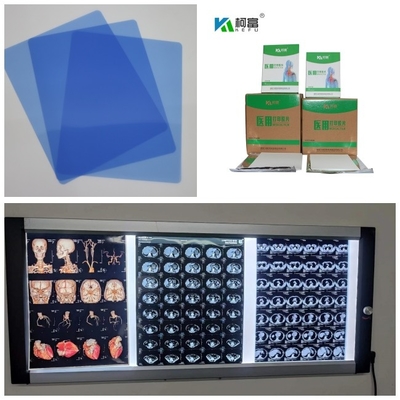 Impressão de filme de raios X de 150 microns, velocidade de impressão de 1 a 3 minutos, para medicamentos de 10 polegadas.
