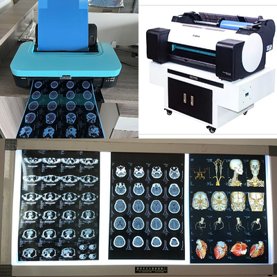 210um da polegada médica da saída 8x10 14X17 da imagem do Inkjet base azul X Ray Film 3D CT MRI