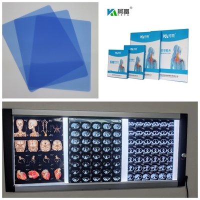 Polegada médica da saída 8x10 11x14 14X17 da imagem do Inkjet X Ray Film 3D do Dr. MRI do CT