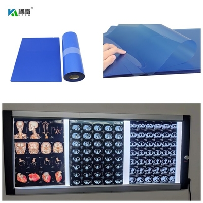 Película de jato de tinta médica de base PET azul com alta estabilidade de imagem com alta resolução