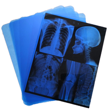 Filme de raios-X Médicos de Baixo nevoeiro com Resolução de 320dpi 14 x 17 em Led X Ray Film View Box