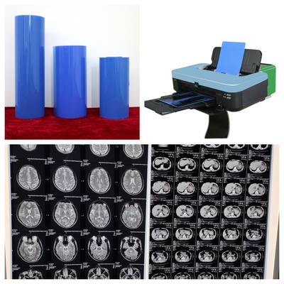 Alta Durabilidade Inkjet Filme de Raios X Médico Azul de Longa Duração Estabilização de Imagem Azul