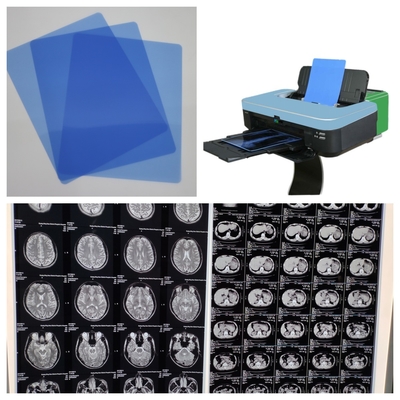 210 Microns Blue Inkjet X Ray Film IRM Imagem de saída com alta qualidade de impressão para preto e branco