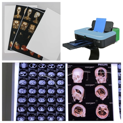 9600x2400dpi Inkjet X Ray Film PET Azul Transparente Para Imagem Médica de Alta Resolução