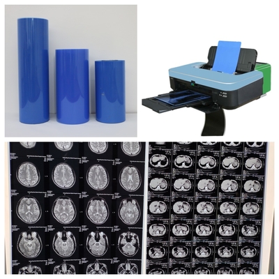 Película de jato de tinta médica de base PET azul com alta estabilidade de imagem com alta resolução