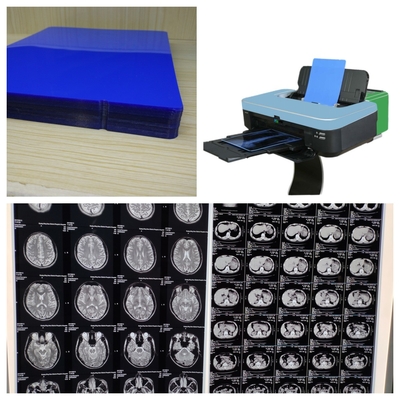 210 Microns PET Inkjet X Ray Film 14 polegadas com alta estabilidade de imagem