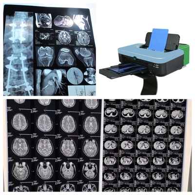 Filme de raios-X a jato de tinta de 10 polegadas para imagens médicas de 210 microns