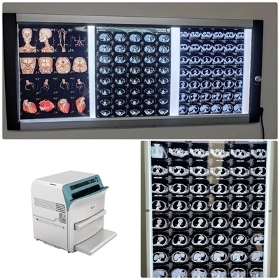 Filme seco médico de alta resolução de raios X 10x12 para DR CT MRI DSA saída de imagem compatível com impressora Fuji