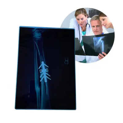 Impressora térmica médica seca Impressora CT Filme a jato de tinta Azul A4 PET Equipamento médico ortopédico Filmes de raios X
