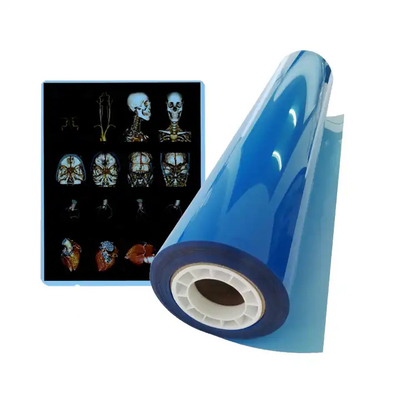 Impressora térmica médica seca Impressora CT Filme a jato de tinta Azul A4 PET Equipamento médico ortopédico Filmes de raios X